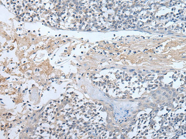 Immunohistochemistry of paraffin-embedded Human tonsil tissue using ABR Polyclonal Antibody at dilution of 1:50(×200)