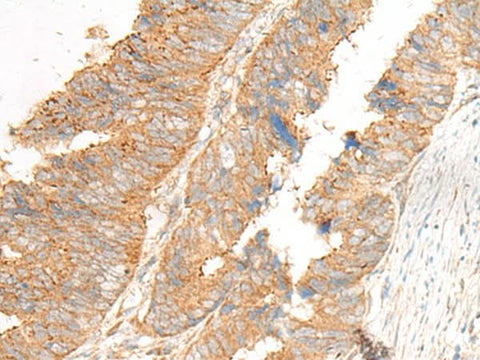 Anti-Human GLIS1 Antibody - ABMIUM