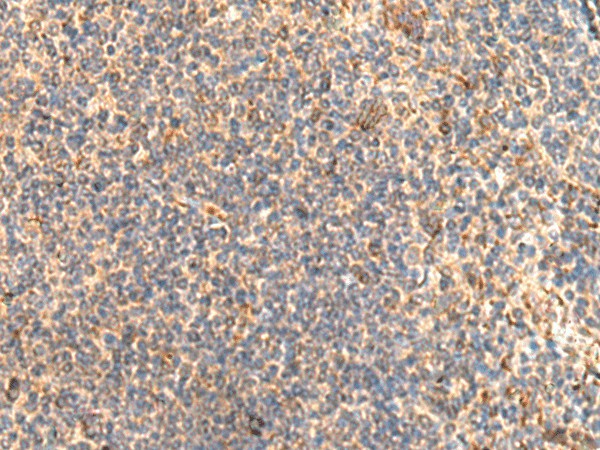 Immunohistochemistry of paraffin-embedded Human tonsil tissue using ABHD2 Polyclonal Antibody at dilution of 1:40(×200)