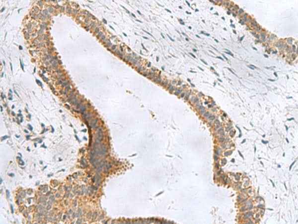Anti-Human/Mouse CEMIP Antibody