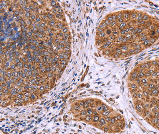 Anti-Human/Mouse/Rat CLUAP1 Antibody - ABMIUM