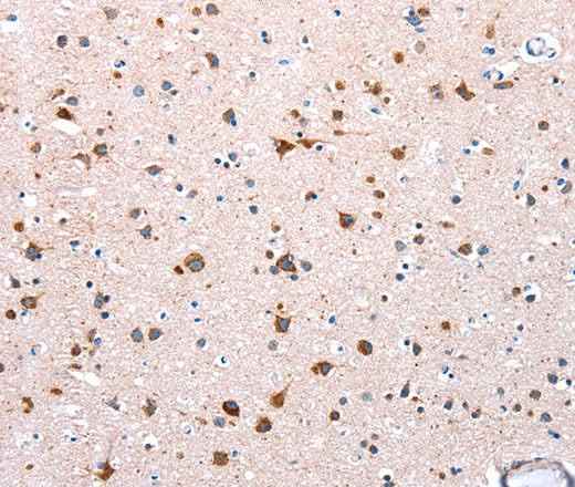 Anti-Human/Mouse NDUFA12 Antibody