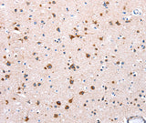 Anti-Human/Mouse NDUFA12 Antibody - ABMIUM