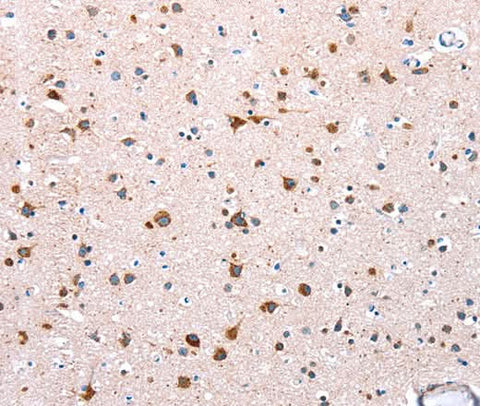 Anti-Human/Mouse NDUFA12 Antibody - ABMIUM