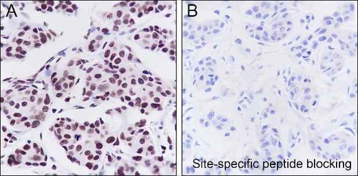 Anti-Human JunB Antibody [A270] - ABMIUM
