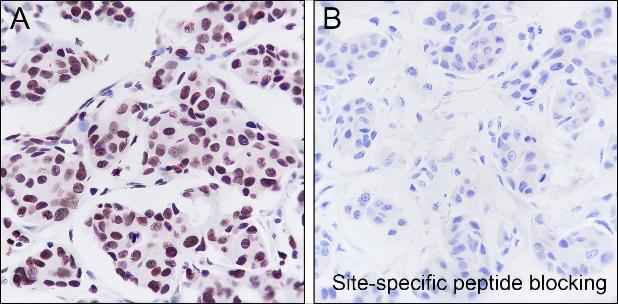 Anti-Human JunB Antibody [A270]