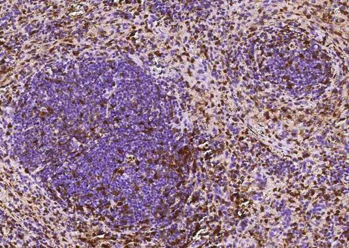 Anti-Mouse S100A6 Antibody [B424] - ABMIUM