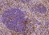 Anti-Mouse S100A6 Antibody [B424]
