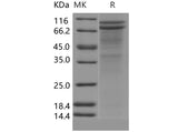 > 75 % as determined by reducing SDS-PAGE.