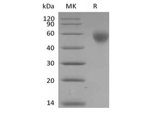 Recombinant Human SLAM family member 1/SLAMF1/CD150 (C-6His-Avi) Biotinylated - ABMIUM