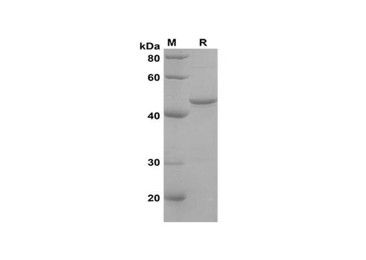 SDS-PAGE analysis of Human AIF1 proteins, 2 μg/lane of Recombinant Human AIF1 proteins was resolved with SDS-PAGE under reducing conditions, showing bands at 45 kDa.