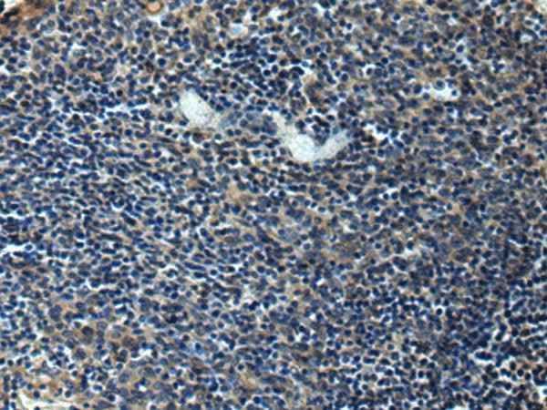 Anti-Human/Mouse/Rat ERLIN1 Antibody
