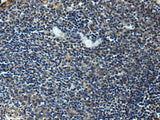 Immunohistochemistry of paraffin-embedded Human tonsil tissue using ERLIN1 Polyclonal Antibody at dilution of 1:50(×200)