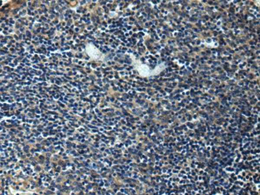Anti-Human/Mouse/Rat ERLIN1 Antibody