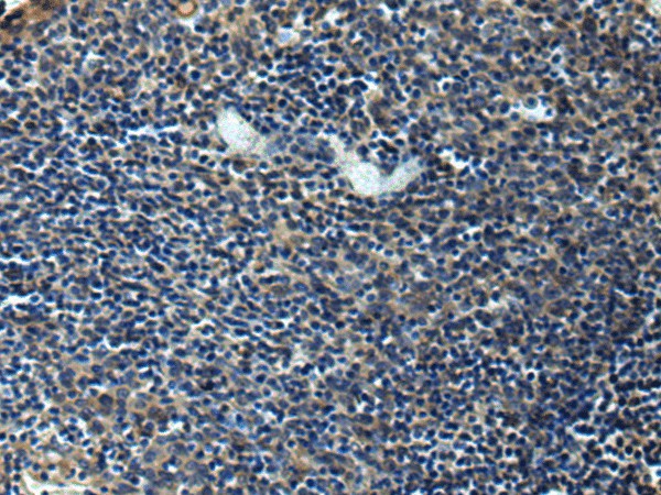 Immunohistochemistry of paraffin-embedded Human tonsil tissue using ERLIN1 Polyclonal Antibody at dilution of 1:50(×200)