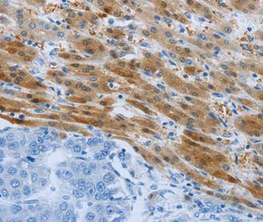 Anti-Human/Mouse/Rat PSMD11 Antibody
