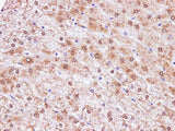 Immunohistochemistry of paraffin-embedded Human liver using CCL2 Polyclonal Antibody at dilution of 1:100