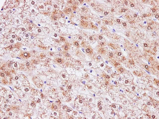 Immunohistochemistry of paraffin-embedded Human liver using CCL2 Polyclonal Antibody at dilution of 1:100