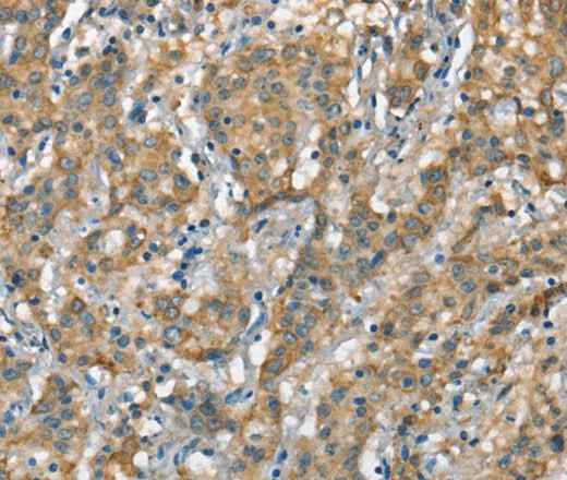 Anti-Human/Mouse CSMD1 Antibody
