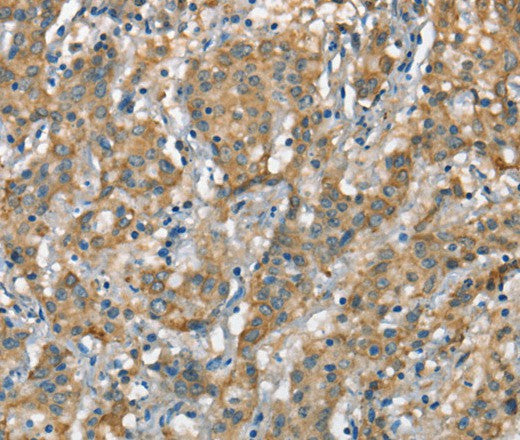 Anti-Human/Mouse CSMD1 Antibody - ABMIUM