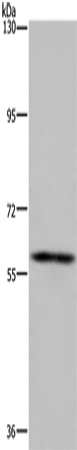 Anti-Human FTO Antibody - ABMIUM