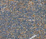 Anti-Human/Mouse/Rat GRB7 Antibody - ABMIUM