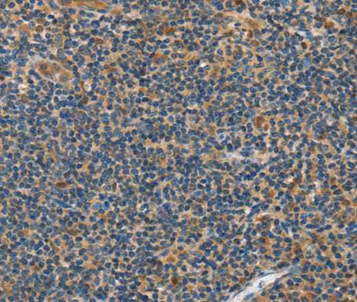Anti-Human/Mouse/Rat GRB7 Antibody