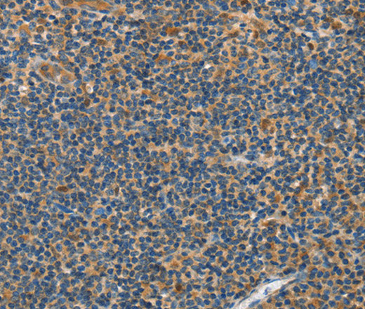 Anti-Human/Mouse/Rat GRB7 Antibody - ABMIUM