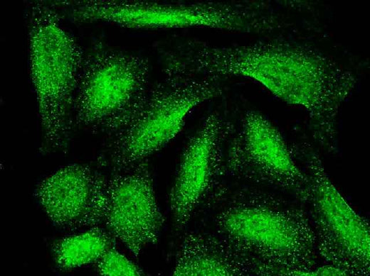 Anti-Human ARL2BP Antibody [B376] - ABMIUM
