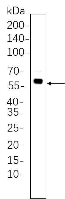 Anti-Human/Mouse/Rat/Drosophila Akt Antibody [B1093] - ABMIUM
