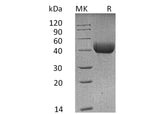 Recombinant Mouse SFTPD/SP-D Protein (His Tag) - ABMIUM