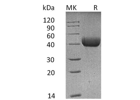 Recombinant Mouse SFTPD/SP-D Protein (His Tag) - ABMIUM