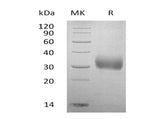 SDS-PAGE analysis of Human Sclerostin/SOST proteins, 2 μg/lane of Recombinant Human Sclerostin/SOST proteins was resolved with SDS-PAGE under reducing conditions, showing bands at 35 kDa.