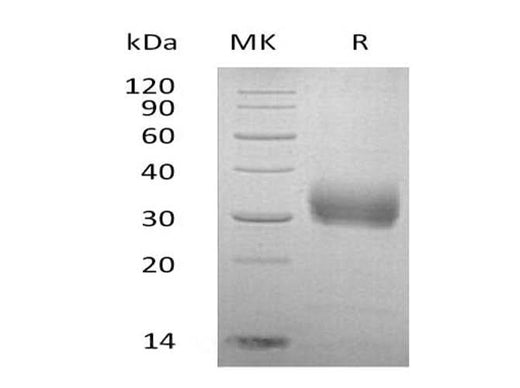 SDS-PAGE analysis of Human Sclerostin/SOST proteins, 2 μg/lane of Recombinant Human Sclerostin/SOST proteins was resolved with SDS-PAGE under reducing conditions, showing bands at 35 kDa.