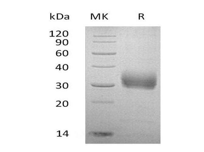 SDS-PAGE analysis of Human Sclerostin/SOST proteins, 2 μg/lane of Recombinant Human Sclerostin/SOST proteins was resolved with SDS-PAGE under reducing conditions, showing bands at 35 kDa.