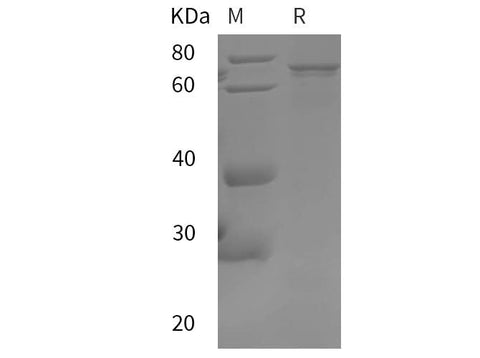 SDS-PAGE analysis of Human AKT1 proteins, 2 μg/lane of Recombinant Human AKT1 proteins was resolved with SDS-PAGE under reducing conditions, showing bands at 75 kDa.