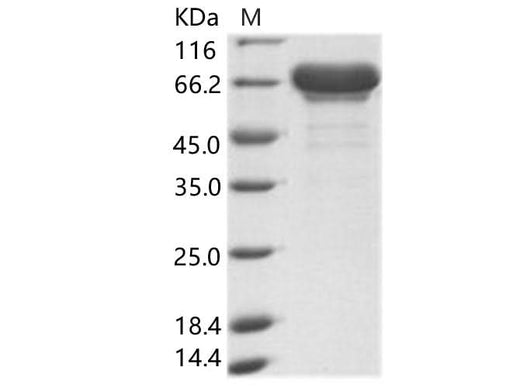 Recombinant EBOV (subtype Sudan, strain Gulu) VP40 / Matrix protein VP40 Protein (His & MBP Tag) - ABMIUM