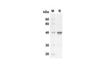 SDS-PAGE analysis of Human HSP-27/HSPB1 proteins, 2 μg/lane of Recombinant Human HSP-27/HSPB1 proteins was resolved with an SDS-PAGE under reducing conditions, showing bands at 35.4 kDa.