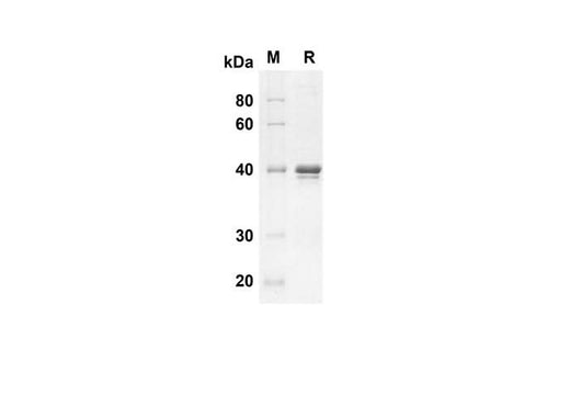 SDS-PAGE analysis of Human HSP-27/HSPB1 proteins, 2 μg/lane of Recombinant Human HSP-27/HSPB1 proteins was resolved with an SDS-PAGE under reducing conditions, showing bands at 35.4 kDa.