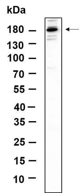 Anti-Human/Mouse/Rat TIAM2 Antibody [B982]