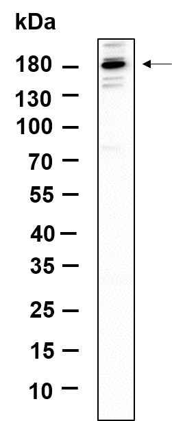 Anti-Human/Mouse/Rat TIAM2 Antibody [B982] - ABMIUM