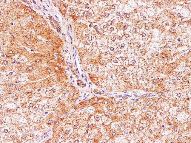 Immunohistochemistry of paraffin-embedded Human liver using IL2 Polyclonal Antibody at dilution of 1:100
