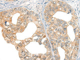 Anti-Human CORO2A Antibody - ABMIUM