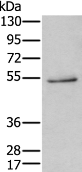 Anti-Human HTR3C Antibody - ABMIUM