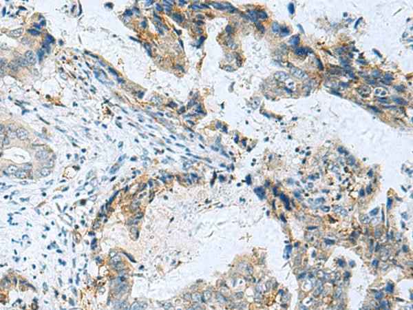 Anti-Human/Mouse/Rat RMDN2 Antibody
