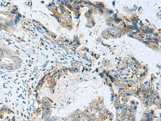 Anti-Human/Mouse/Rat RMDN2 Antibody