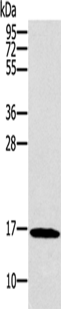 Anti-Human SNCG Antibody - ABMIUM