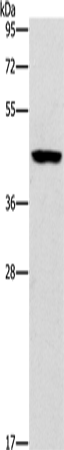 Anti-Human/Mouse/Rat B3GAT1 Antibody - ABMIUM