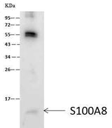 Anti-Human S100A8 Antibody [B141]