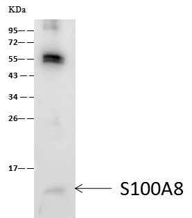 Anti-Human S100A8 Antibody [B141] - ABMIUM